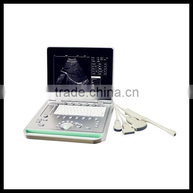 (Pregnant week,fetal weight,volume.etc) Both use in human and animal new portable laptop ultrasound machine/scanner/system price