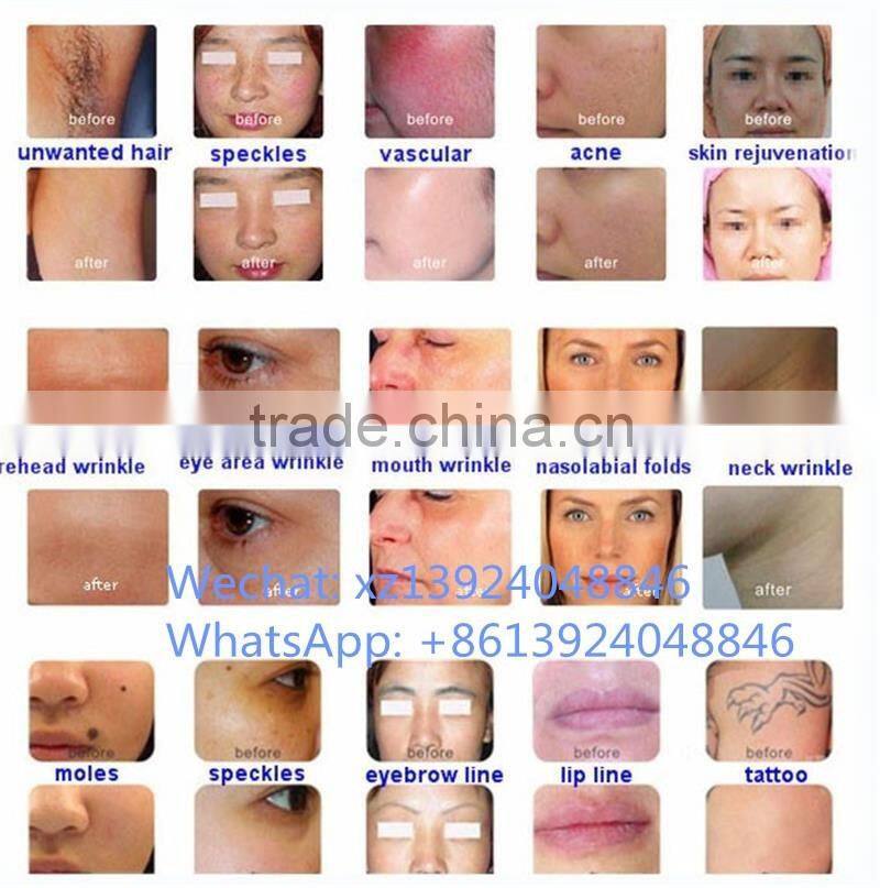 Skin care products acne scar removal & ipl shr opt hair removal beauty equipment