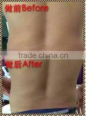 2016 high quality best selling fat reduction body shaping weight loss instrument