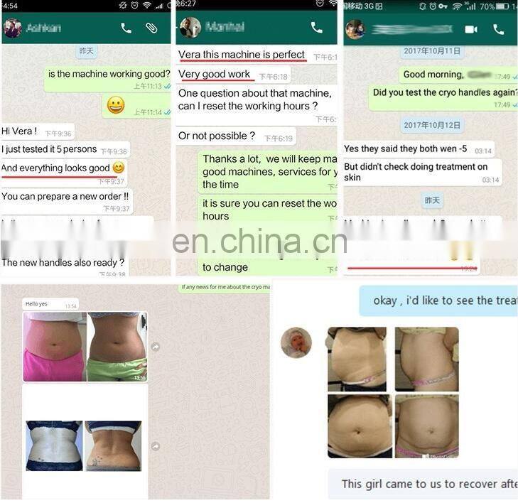 Best new product CE approved fast slimming machine lipolaser fat loss beauty equipment