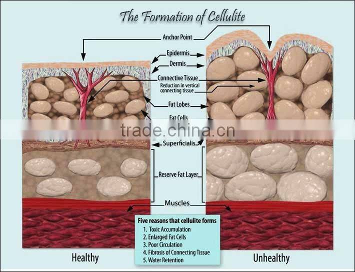 real factory electro acupuncture stimulation machine