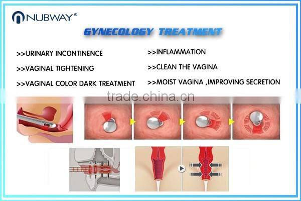 USA Laser Vaginal Tighten Medical Use RF Fractional Co2 Laser