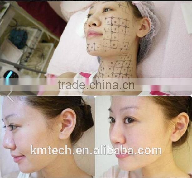 CE ISO TUV BV approved machine radio frequency facial for skin tightening