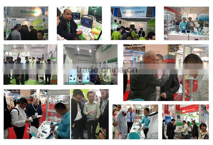 Sonostar good quality handheld portable vet ultrasound scanner pig veterinary ultrasound V6