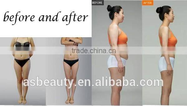 portabl device RF cavitation cryo lipo laser machine body slimming