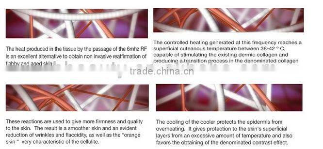 40KHZ weight loss cavitation rf slimming machines