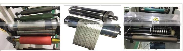 customized medical dressing rotary die cutting machine