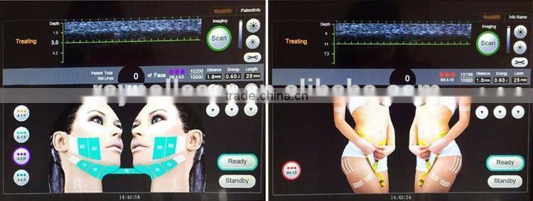 Best Price 5 Transducers Ultra HIFU Face Lift and Slimming Machine