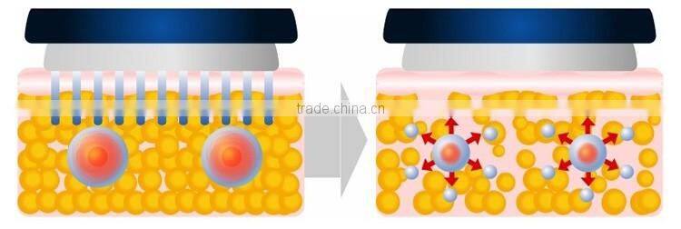 5 in 1 fast cavitation rf machine korea