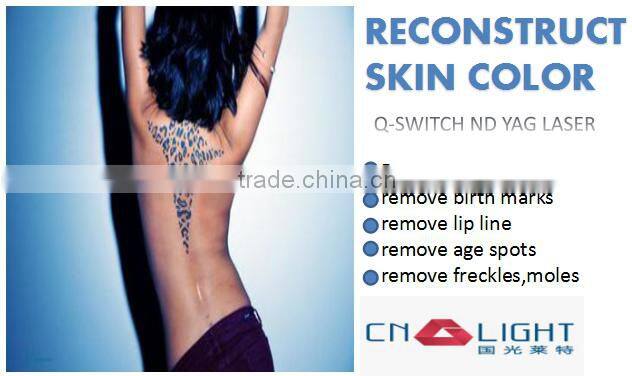 Portable tattoo removal Q-switch1064 nm 532nm nd yag laser machine for home use