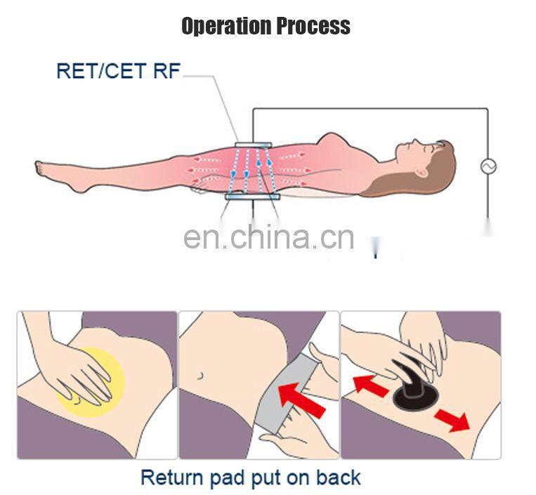 KYAINDIBA Body Care Ret Cet RF 448KHz Diatherapy Body Shaping Machine RET CET Tecar Therapy Face Lift Pain Relief Body Detox