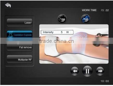 lipo laser cavitation