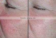 Hot Korea new product led mask 7 colors led skin rejuvenator mask for clinic or salon use