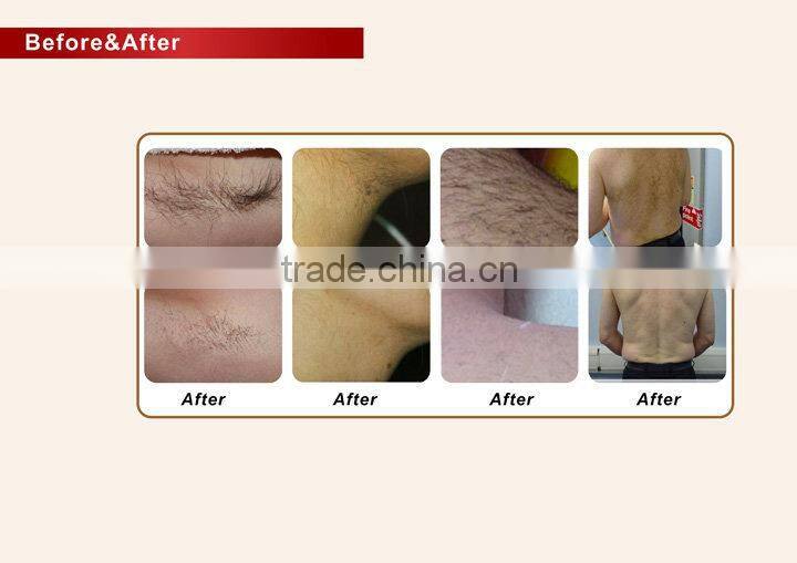 Vertical 808nm laser diode depilation hair removal skin rejuvenation diode laser machine