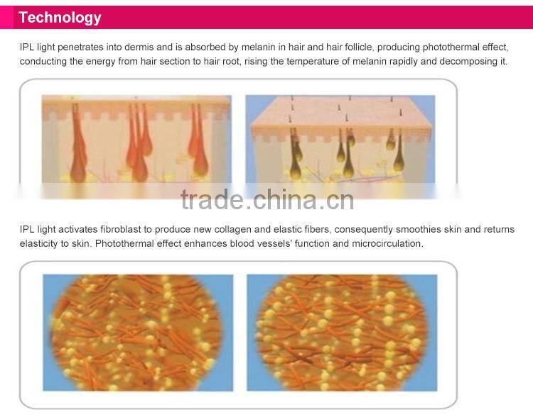 Home use IPL epilator device/ipl acne clean Professional 2016 Bikini Permanent Removal System IPL Laser Hair Removal device For