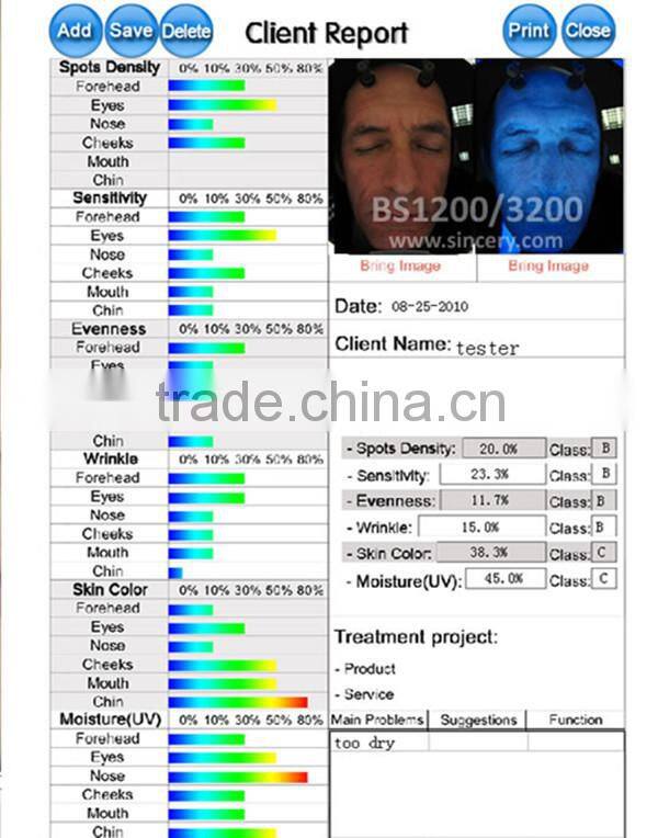Skin analyzer professional 3D Facial Skin Analysis BS3200