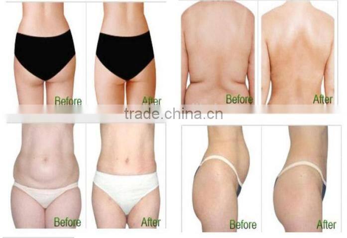fat removal cryo slimming machine/cryo machine