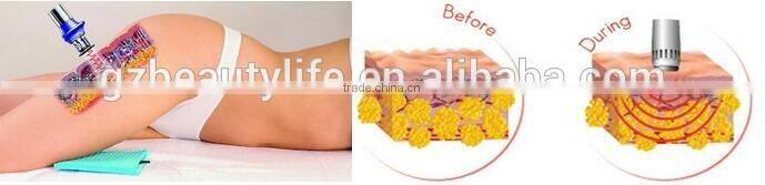 Extracorporeal Shock Wave Therapy SWET Beauty Equipment