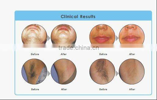 super body shaping & hair removal machine (TGA certificate)