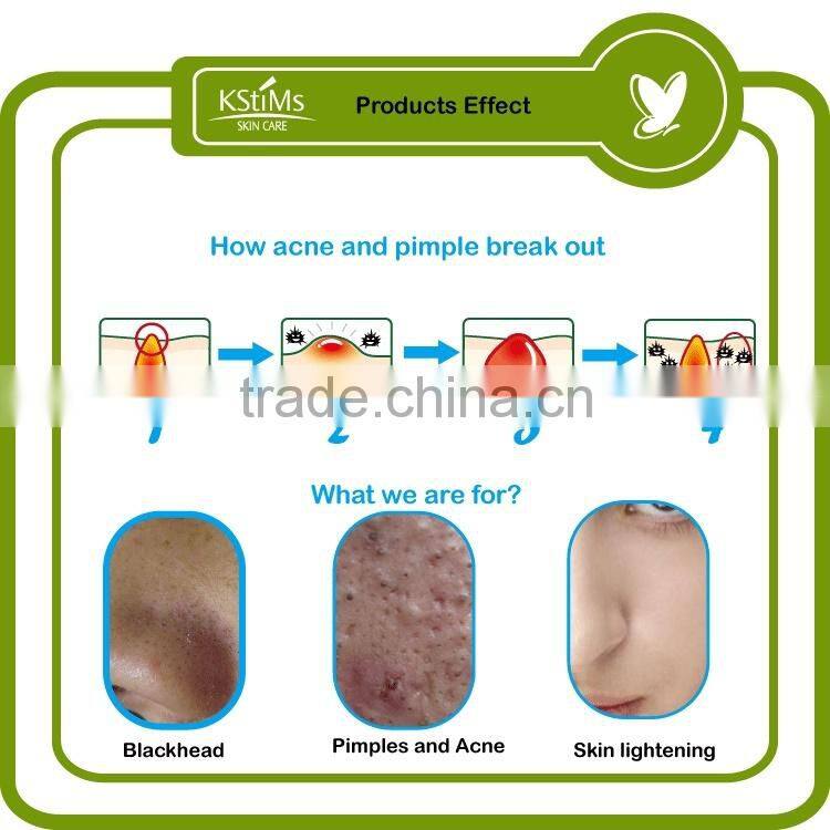 Natural herbal formula Tea tree oil Anti Acne and pimple treatment cream