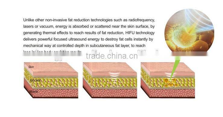 Professional Face Lift Hifu Ultra Slimming Machine With Liposonix