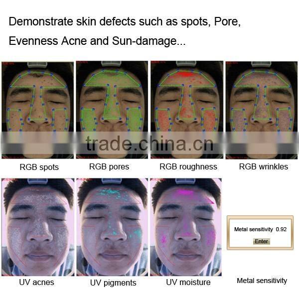 Hot sale portable skin analyzer machine 3D magic mirror skin test machine