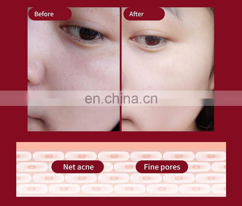 new trend product skin care beauty mask facial electric graphene device