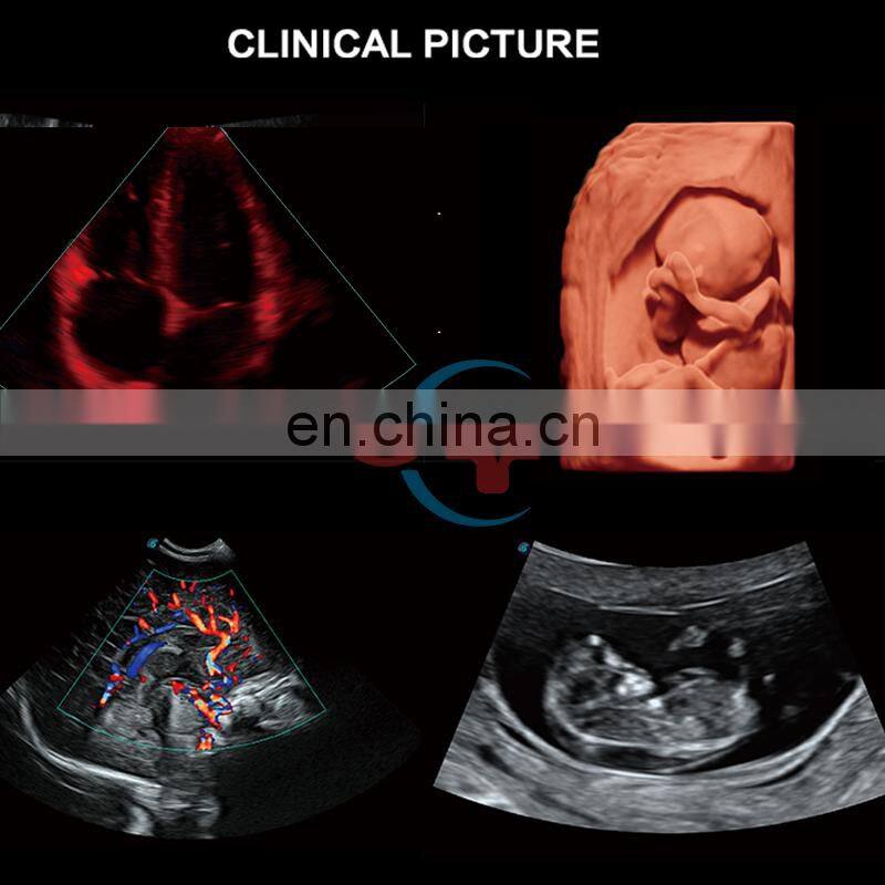 Competitive hospital medical equipment trolley Sonoscape 4d /Ultrasound scanner /Sonoscape S50 Elite