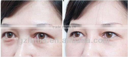 2013-2017 the most Excellent+Effective+Exquisite cavitation sliming machine ( 2-4cm size reduce /time, AMAZING RESULT!!)