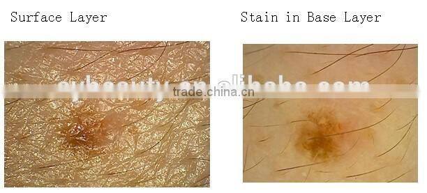 AYJ-J016 beauty salon equipment Portable Intelligent Digital Skin Analyzer 3d