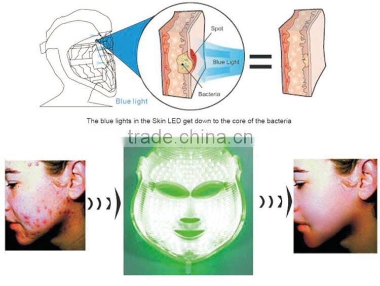 best three color pdt led light acne mask/acne treatment light therapy machine