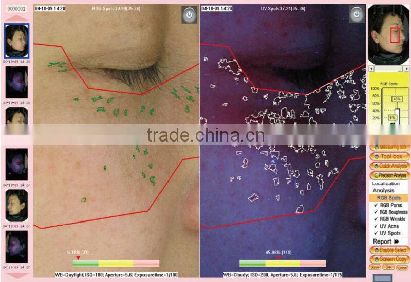portable skin analyze machine/uv skin analyzer/skin analyzer