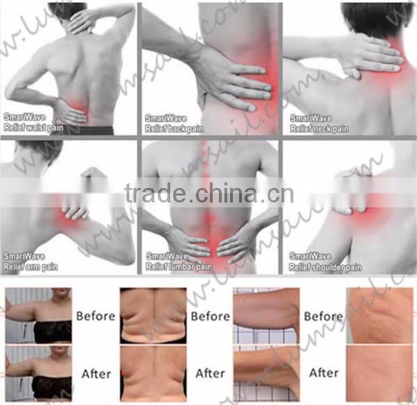 Elbow Pain shockwave equipment/ RSWT for Elbow Pain Treatment/ trigger point treatment