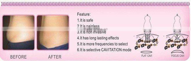 best body shaping slimming equipment