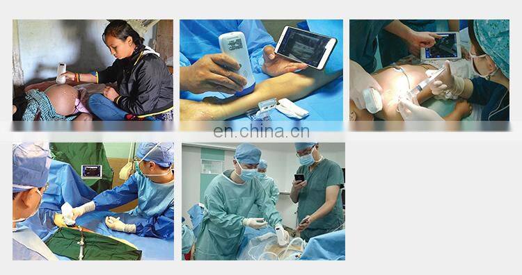 Sales 2022 factory price portable wireless ultrasound scanner ultrasound machine