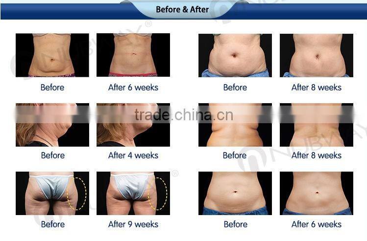 Multi-Function Beauty Equipment reduce belly fat naturally