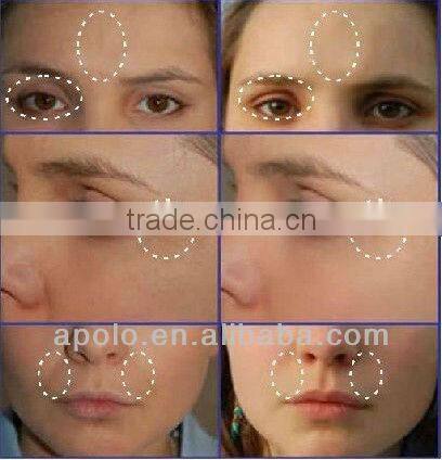 RF skin tightening and lifting beauty instrument- Med.apolo HS-530