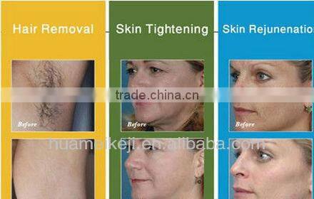 3 in 1 rf elight laser multifunction beauty machine