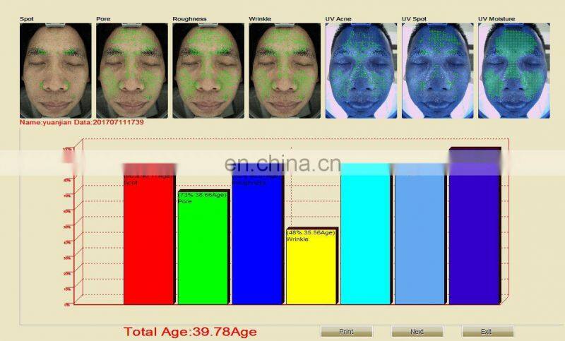 Multi Function light facial skin analysis machine for Skin Sensitiveness And Age Test