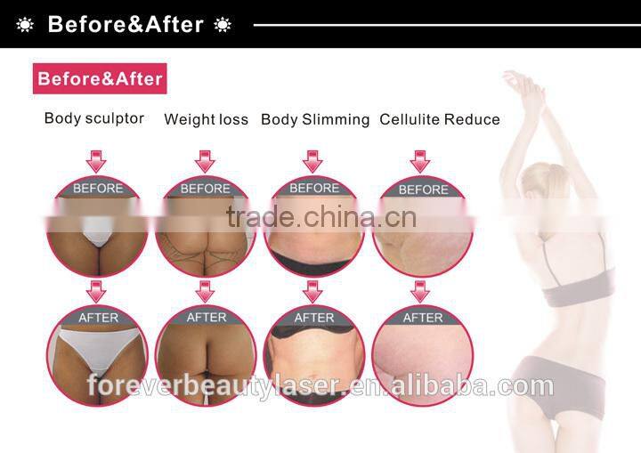 High tech weight loss lipo laser body slimming, cellulite reduction lipo laser machine LP01