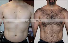 Newest !! venus mini ipl machine/e light device with CE,ISO,TUV