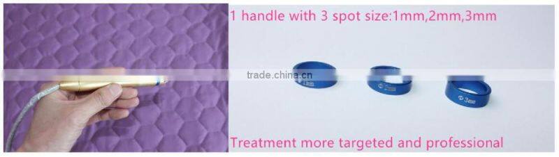 permanent remove vascular machine by 980nm diode laser