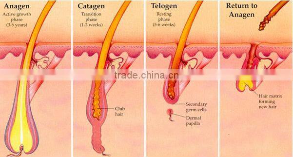 Newest Model Diode Depilatory Machine!! Laser 808nm Hair Removal Laser with Teaching Video