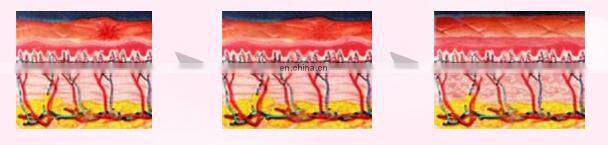 DEESS 3 in 1 with effect replaceable lamps device ipl hair removal beauty product