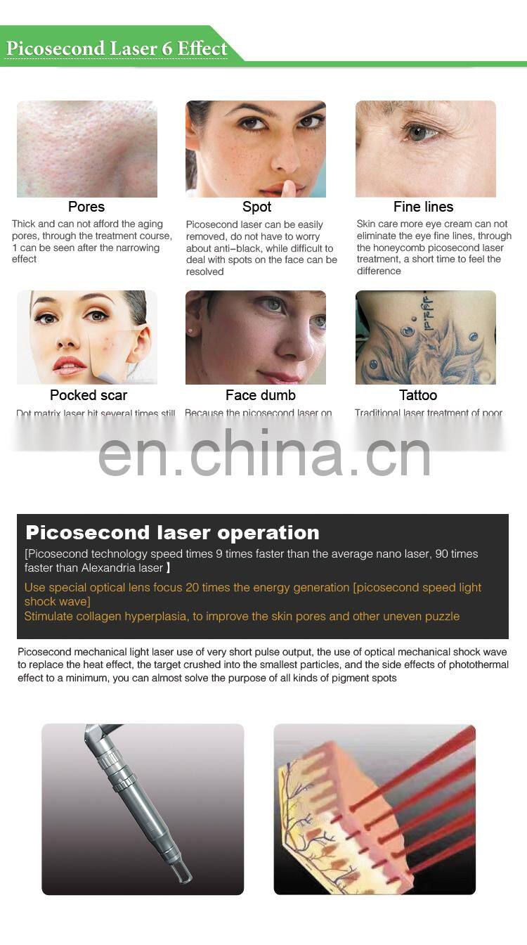 2021 most popular medical ce approved machine picosecond laser pico laser for tattoo removal