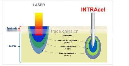 2 professional treatment handles radiofrecuencia fraccionada