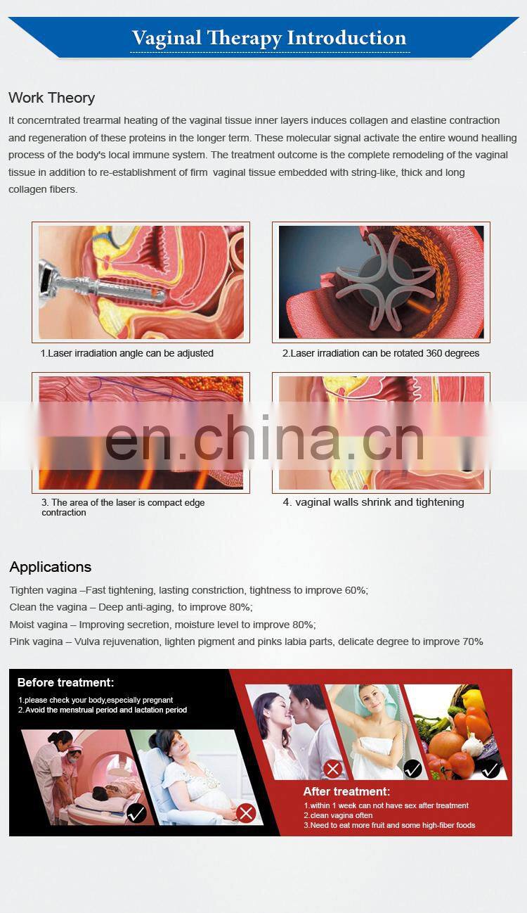 70W medical fractional co2 laser/co2 fractional laser/laser co2 fractional with CE