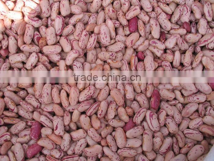 China new crop good quality light speckled Pinto Kidney Bean