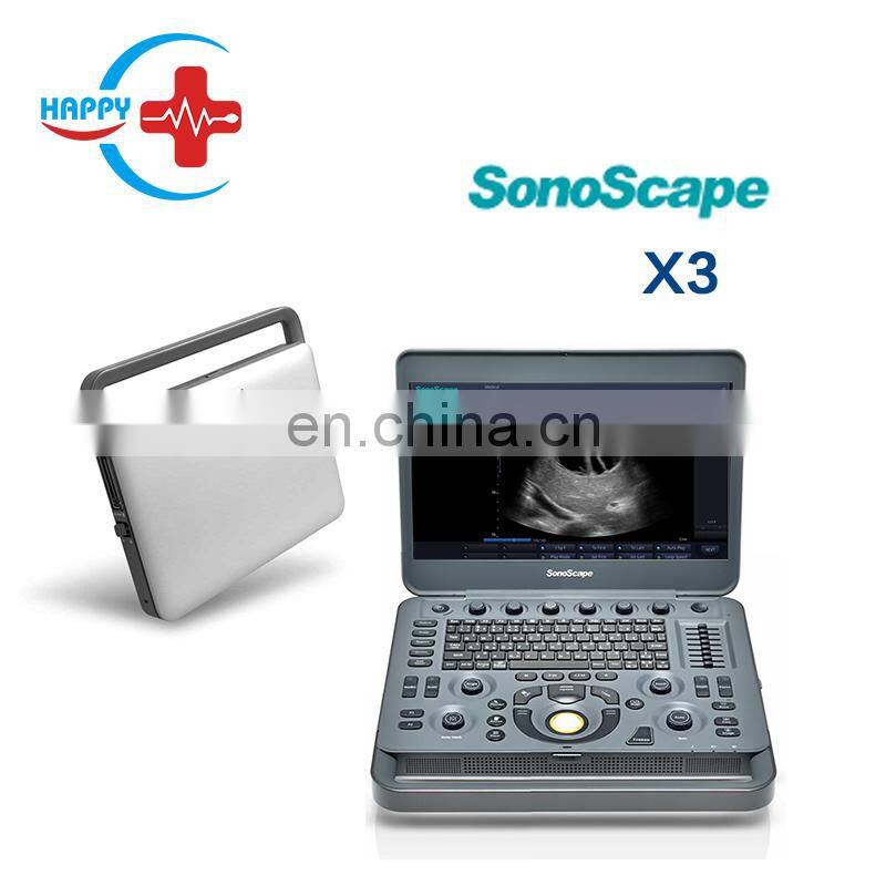 Cheap medical Sonoscape x3 ultrasound machine/Laptop ultrasound scanner/Portable ultrasound probe