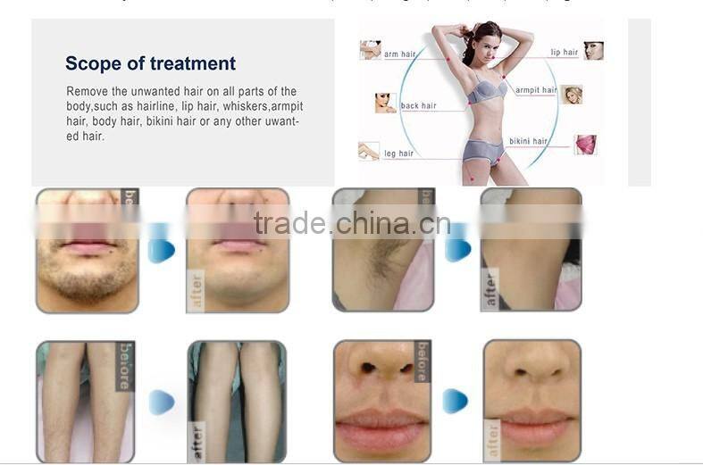 Original Germany 808nm diode laser hair removal machine / 810nm diode laser permanent hair remover